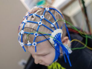 Como identificar e tratar crises de epilepsia infantil